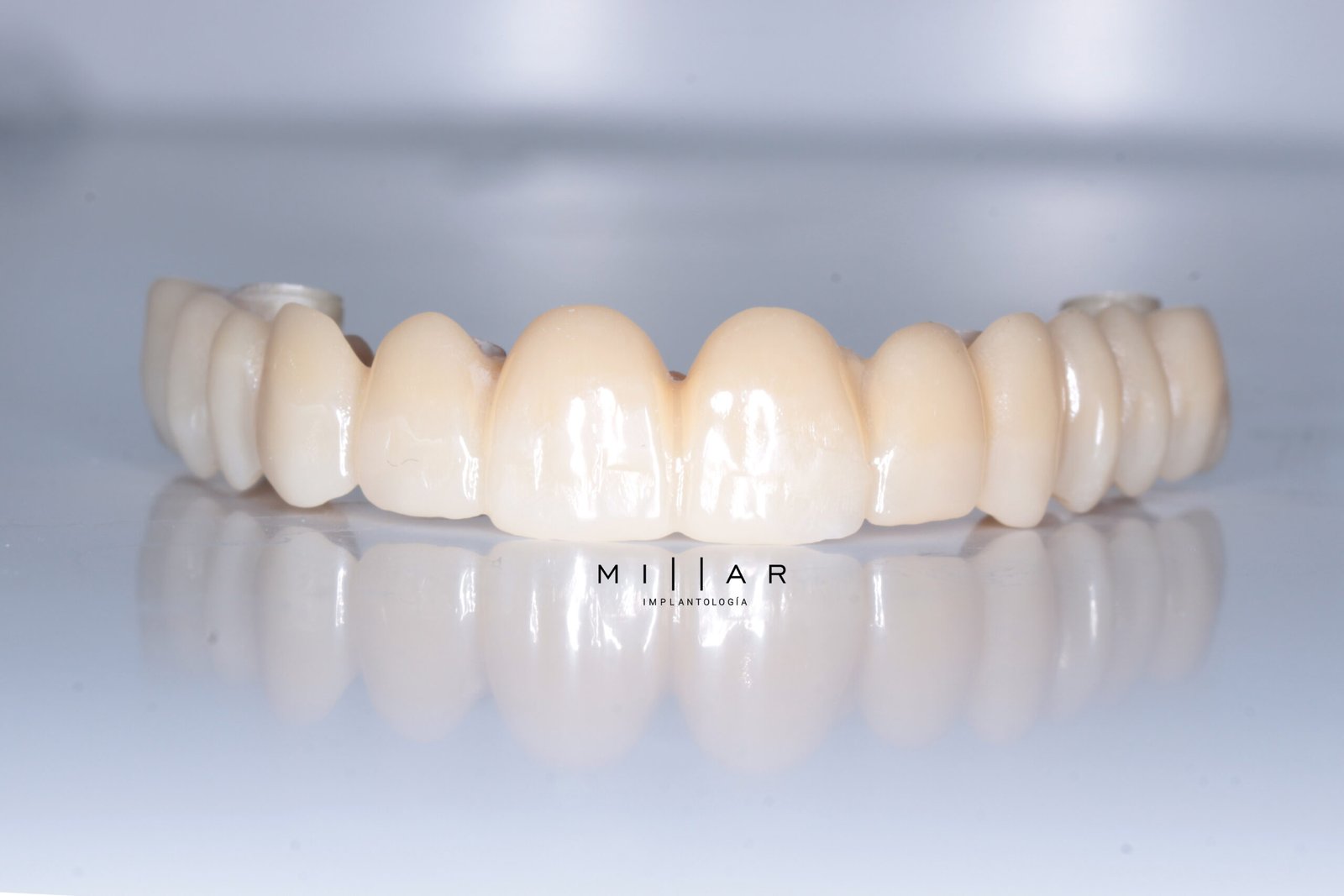 Full Arch sobre 4 a 6 implantes dentales Providencia Santiago